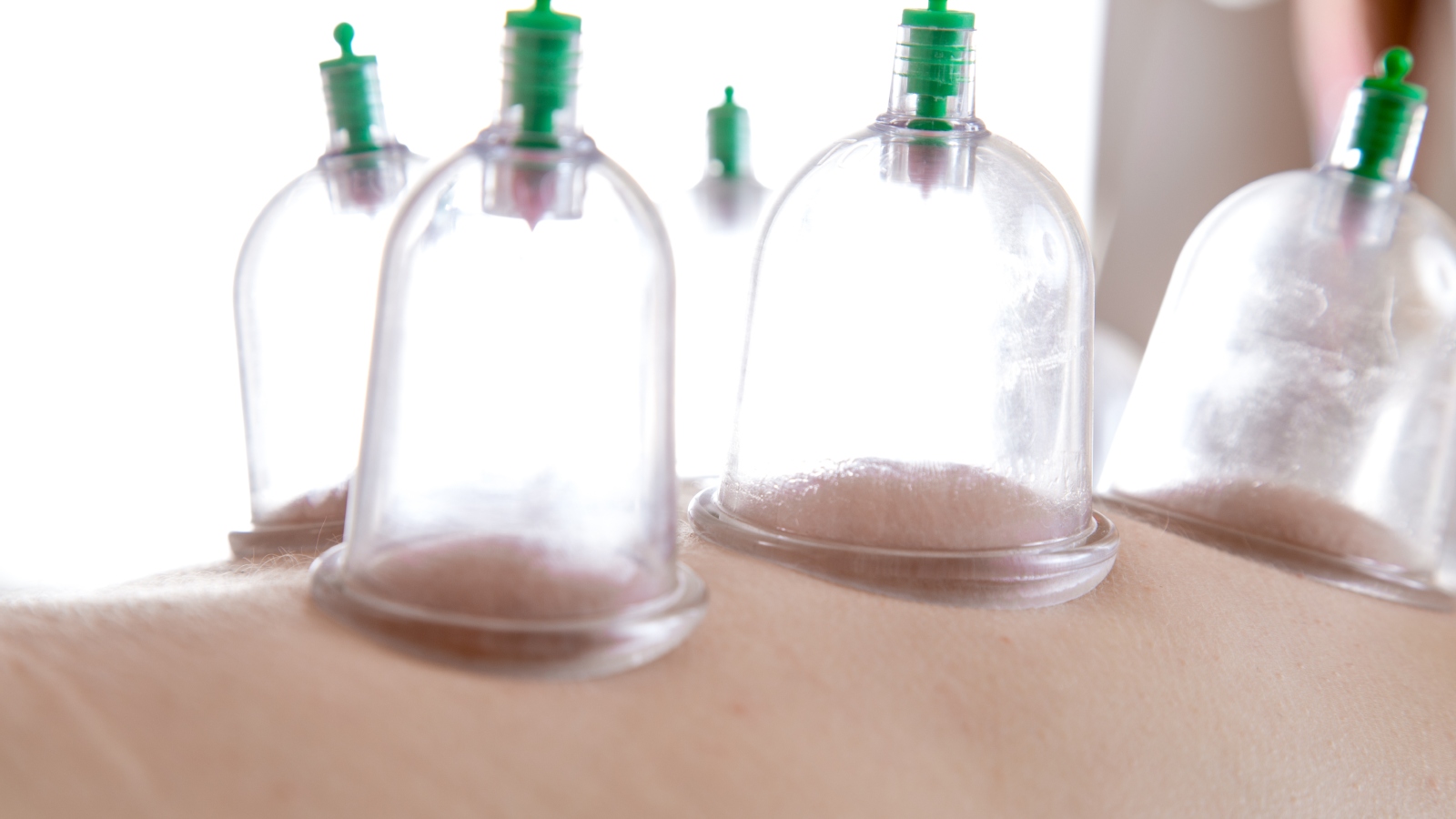 الحجامة... هي الكنز الخفي لمرضى القلب