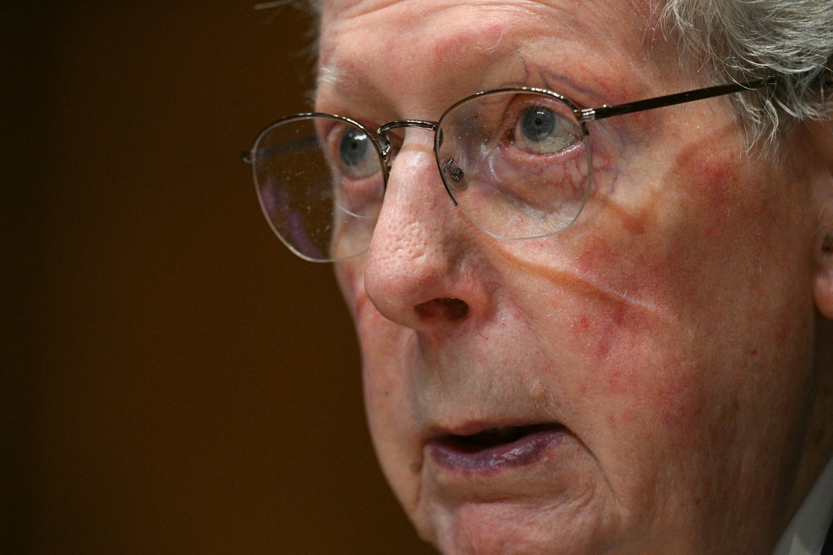 US Senator Mitch McConnell is ‘brain dead’ according to reporters