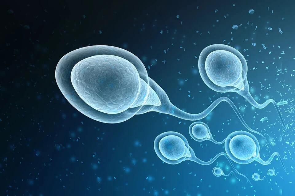 طرق علاج تشوهات الحيوانات المنوية
