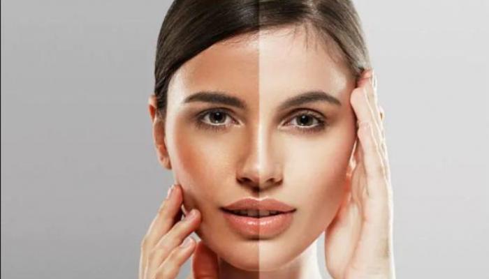 طريقة استخدام حبوب الروكتان للتبييض