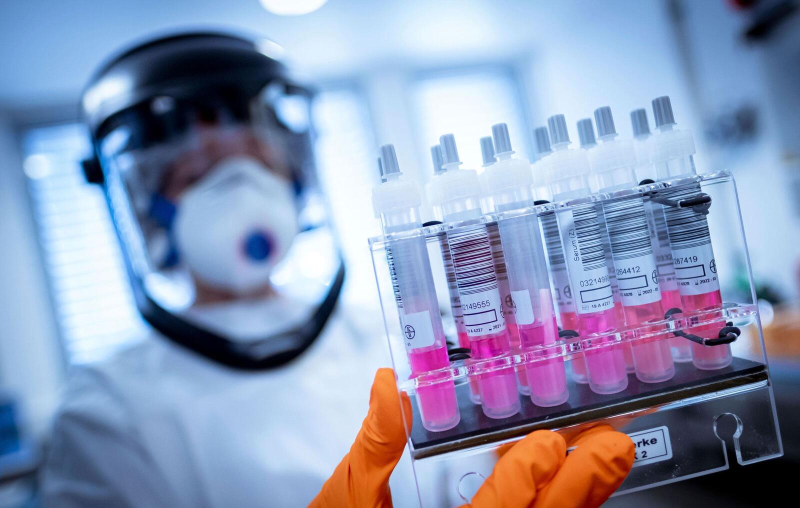 توفي 12 ألفا و 329 شخصا في الأردن جراء الفيروس