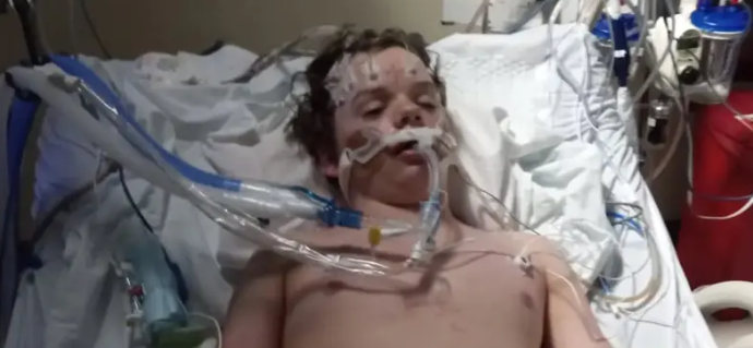 حبوب الهلوسة