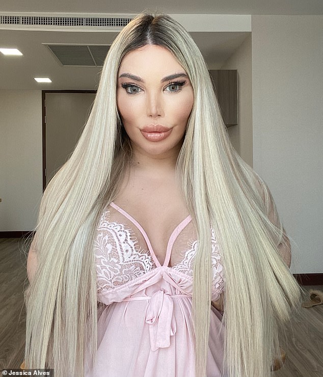 المتحول الجنسي رودريغيز ألفيس