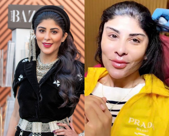 زارا البلوشي