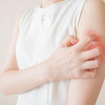 من أسباب الطفح الجلدي التعرّض لمستحضرات التجميل الخاصّة بالأطفال  من أسباب الطفح الجلدي التعرّض لمستحضرات التجميل الخاصّة بالأطفال