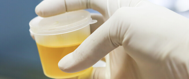 تفسير حلم البول الأصفر في المنام للرجل