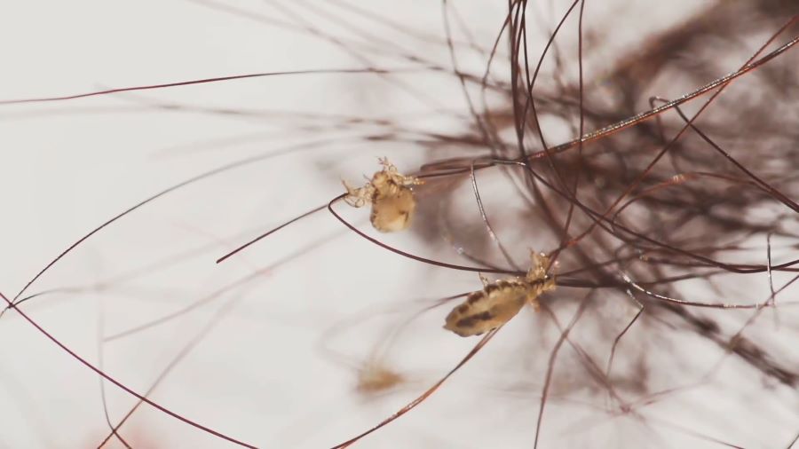 تفسير رؤية القمل الأبيض في المنام وقتله للمتزوجة