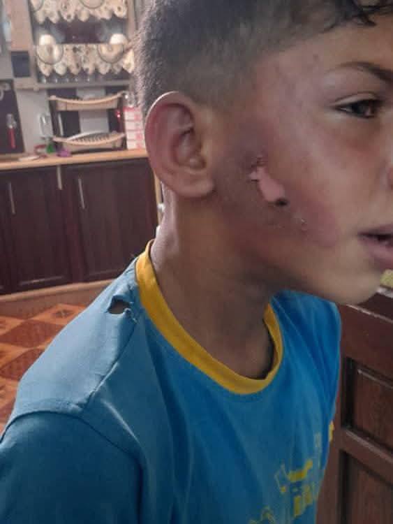 orphan boy Ibrahim Khalil al-Sateef
