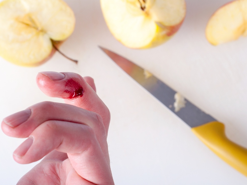 ما رمزية الحلم بقطع إصبعك في المنام؟