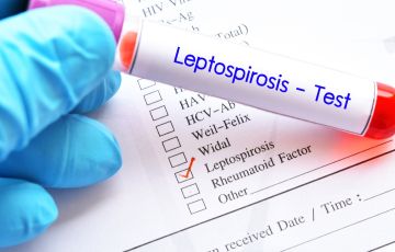مرض الليبتوسبيروسس: الأعراض، التشخيص، العلاج