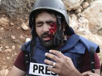 Palestinian cameraman Mu'ath Amarneh gestures after he was hit on the face by a rubber bullet from Israeli border police during clashes between Palestinians and Israeli security forces in the village of Surif northwest of the West Bank town of Hebron on November 15, 2019. HAZEM BADER / AFP