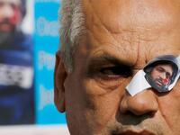 Palestinians are showing solidarity with him by sharing photos of themselves with one closed eye (Twitter)