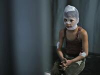 A wounded Syrian child sits at a makeshift clinic in the town of Maaret Misrin following Syrian government forces airstrikes on March 5, 2020 in the country's northwestern Idlib province. Russian air strikes killed at least 15 civilians including a child in the last major opposition bastion of Idlib in northwestern Syria, a Britain-based war monitor said.  Aref TAMMAWI / AFP