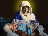 At the Emergency hospital Najiba holds her nephew Shabir, age 2, who was injured from a bomb blast which killed his sister in Kabul on March 29, 2016. Najiba had to stay with the children as their mother buried her daughter. (ugurgallen/ Instagram)
