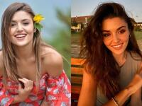 Before and Now Pictures: Hande Erçel Had Her Cheeks, Lips, Mouth and Eyes Done Despite of Denying It