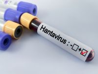 Hantavirus 