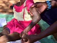 Chepchirchir Kiplagat (L), a 8-year-old child who partially lost the use of her body after a snakebit is held by her father Jackson Chepkui outside their home in the village of Embosos, in the Baringo county on February 22, 2019. 
TONY KARUMBA / AFP