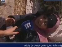 سيدة مصابة من ضحايا مجزرة داريا