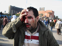 An anti-government protestor holds a cloth to his head injury after clashes with supporters of President Mubarak in Tahrir Square. 