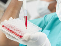 يتم انتقال المرض "الايدز"عن طريق الاتصال الجنسي على مستوى العالم هو بين طرفين من جنسين مختلفين ويتم ايضا من خلال التعرض لدم ملوث بالمرض او انتقال الفيروس من الأم الحامل لطفلها.