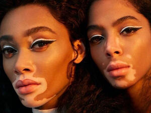 Winnie Harlow and Shahad Salman 