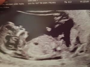The couple were shocked to see what they believe is a guardian angel (top right) in the 12-week scan. (Daily Mail)