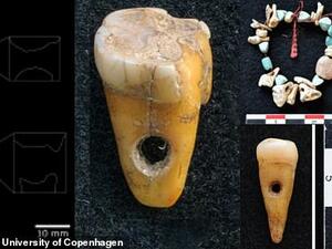 The group of researchers believe their samples are the earliest example of artificially modified human teeth in the region. (University of Copenhagen/ Scott D. Haddow)