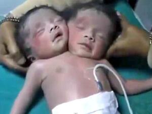 Baby with two heads (Twitter)