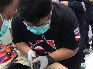 A 21-year-old Thai man was hospitalised on Sunday after getting his penis stuck inside a metal cylinder (dailymail)