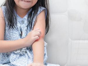 ما هي مسببات الطفح الحراري وطرق علاجه؟