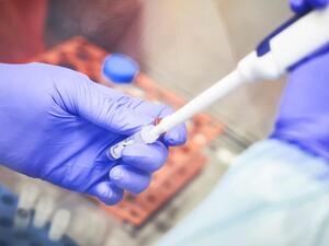  الأطباء يجرون حاليا تجارب سريرية على 86 مريضا مصابين بفيروس كورونا