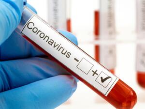 (Shutterstock/ File Photo)