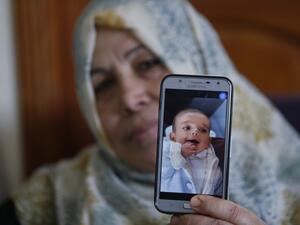 Baby Omar Yaghi was eight months old when he died, unable to travel from Gaza to Israel for life-saving heart surgery after Palestinian officials cut coordination. Yaghi was born with complex heart problems and he started treatment at Israel's Sheba Medical Center when he was just one month old. (MOHAMMED ABED / AFP)