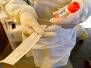 عقار ليفيليماب (الاسم التجاري Ilsira) أصبح ثاني دواء يتم تسجيله في روسيا