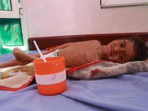 The long conflict has devastated the health system and displaced 3.3 million people who live in camps where cholera and other diseases are rife. ESSA AHMED / AFP