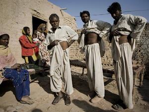 Pakistan Mohamed Ijaz, 25, (2R), displays his scar along with brother Mohamed Riiz, 22, (R), and father Karm Ali, 65, (2L), as his wife Farzana Ijaz, 20, (L), looks on outside his house at a brick factory in Rawalpindi on the outskirts of capital Islamabad on November 18, 2009. (AFP/File Photo)