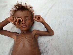 Dozen civilians, mostly women and children, have been killed when Saudi military aircraft struck a residential area in Yemen (Twitter)