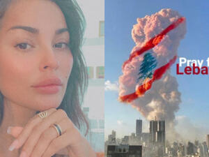 After Reported Missing ... Nadine Njeim Suffers a Serious Injury in Beirut Explosion & Undergoes a 6 Hour Urgent Surgery (Picture)