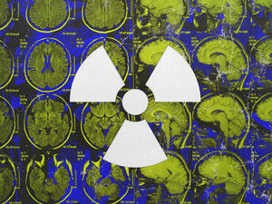 Radiation exposure (Design by Rami Khouri)  Radiation exposure (Design by Rami Khouri)