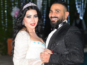 سمية الخشاب بأول رد على خطوبة طليقها أحمد سعد!