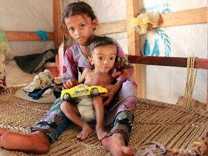 Hundreds of children and pregnant women have been negatively affected by the closure of medical clinics funded by the United Nations Children's Fund (UNICEF) in Yemen's displaced camps. ESSA AHMED / AFP