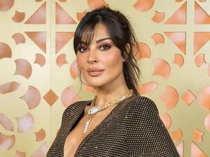 You Will Always Be Beautiful! Nadine Njeim Posts First Clear Picture of Her Bruised Face After Beirut Explosion