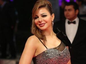 سوزان نجم الدين تطل بتوب قصير..وإبرة في بطنها تثير التساؤل حول خضوعها لعملية جراحية!