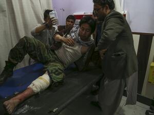 A wounded man receives treatment in a hospital following a suicide bomber blew himself up in an education centre, in Kabul on October 24, 2020. A suicide bomber struck near an education centre in the Afghan capital on October 24, killing at least 18 people in the latest attack to rock the conflict-wracked country. AFP