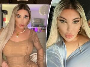 جيسيكا ألفيس