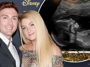 ميغان ترينور