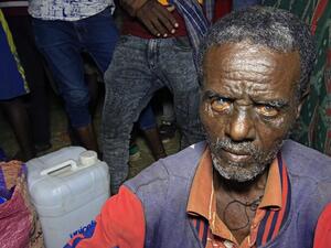 Ethiopian refugees who fled fighting in Tigray province are pictured at the Um Rakuba camp in Sudan's eastern Gedaref province, on November 19, 2020. Sudan -- one of the world's poorest countries, now faced with the massive influx -- has reopened the camp, 80 kilometres (50 miles) from the border. It once housed refugees who fled Ethiopia's 1983-85 famine that killed over a million people. ASHRAF SHAZLY / AFP