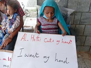 Yemeni war casualties lift anti-Huthi placards during the visit of the Deputy Head of the United Nations Mission to Support the Hodeida Agreement (UNMHA) Daniela Crosslake (unseen) to a hospital in Hays, in Yemen's western Hodeida province, on November 11, 2020. Khaled ZIAD / AFP