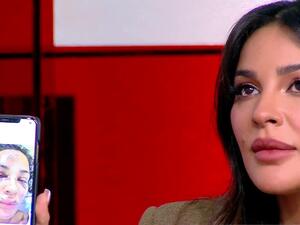 نادين نسيب نجيم تشارك الصُور الأولى لوجهها المتضرر..أسنان مكسورة ودماء تغطي الوجه!