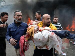 Civilians carry a young victim at the scene of an explosion in the town of Azaz in the rebel-controlled northern countryside of Syria's Aleppo province,on January 31, 2021. A car bomb killed at least four people, including three civilians, in the Turkish-held northern town of Azaz in war-torn Syria today, a war monitor said. Nayef Al-ABOUD / AFP
